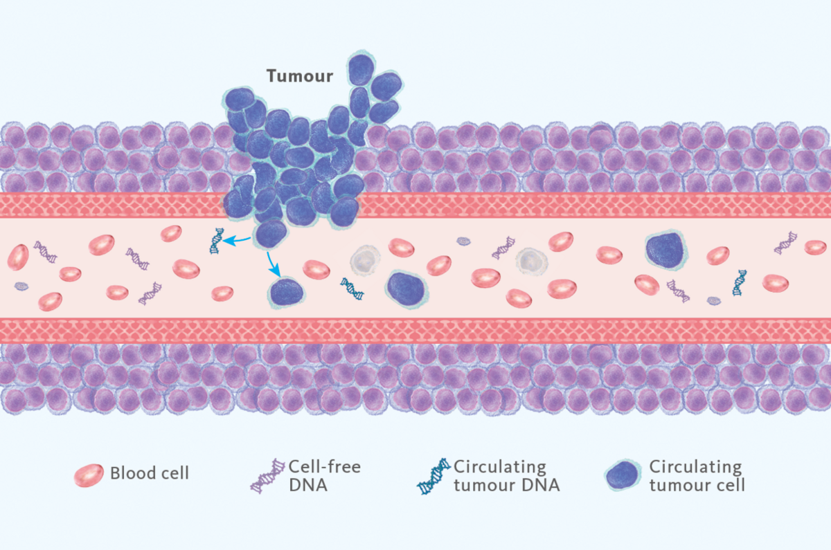 [.TR-tr Turkey (turkish)] Liquid biopsy