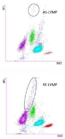 [.TR-tr Turkey (turkish)] Scattergram AS-Lymp RE-Lymp