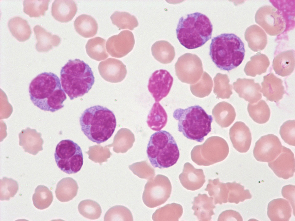 Modified morphology of cells Modified morphology of cells