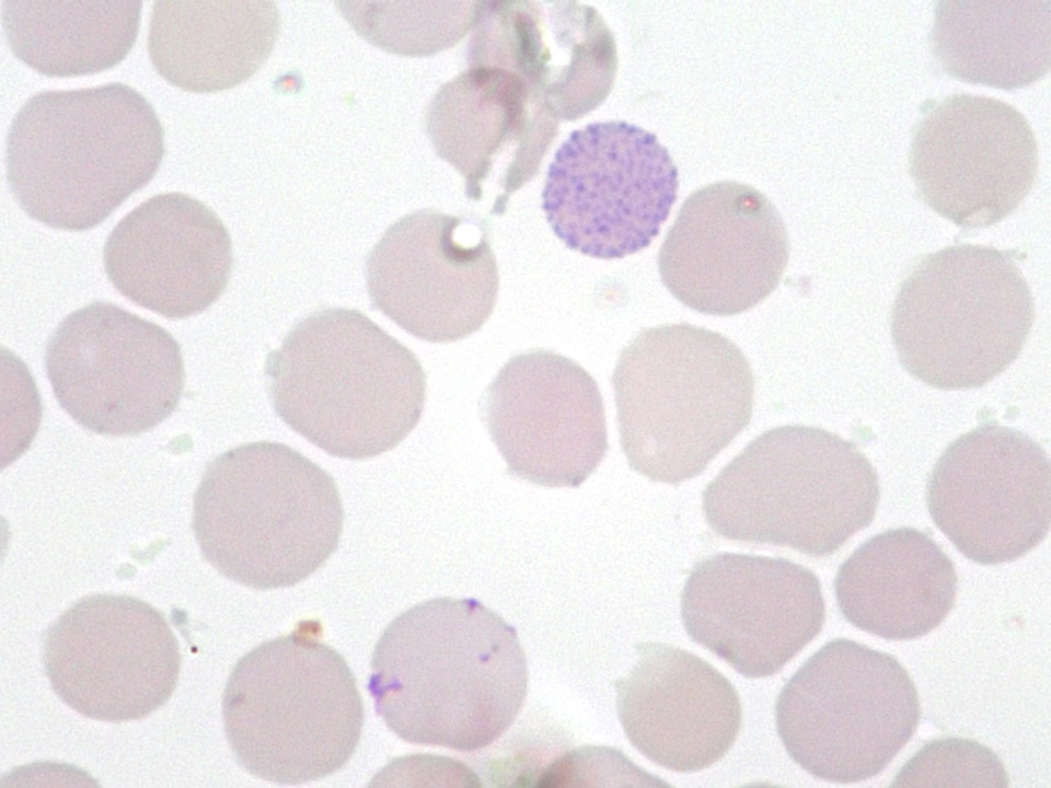 HbH cell HbH cell