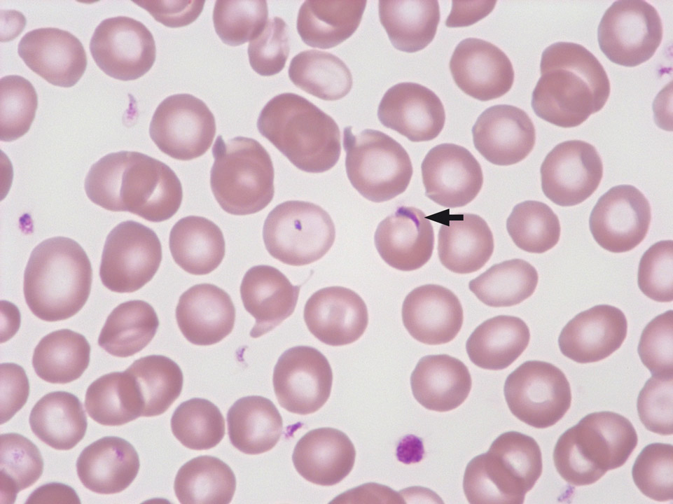 Platelet on top of red blood cell Platelet on top of red blood cell