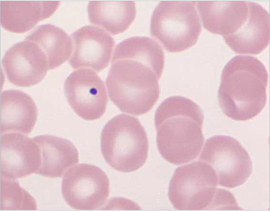 Howell-Jolly-bodies 1 Howell-Jolly-bodies 1