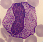 Metamyelocyte Metamyelocyte