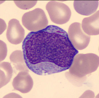 Myeloblast Myeloblast
