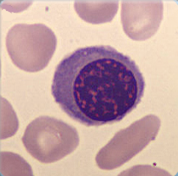 Nucleated Red Blood Cell Nucleated Red Blood Cell